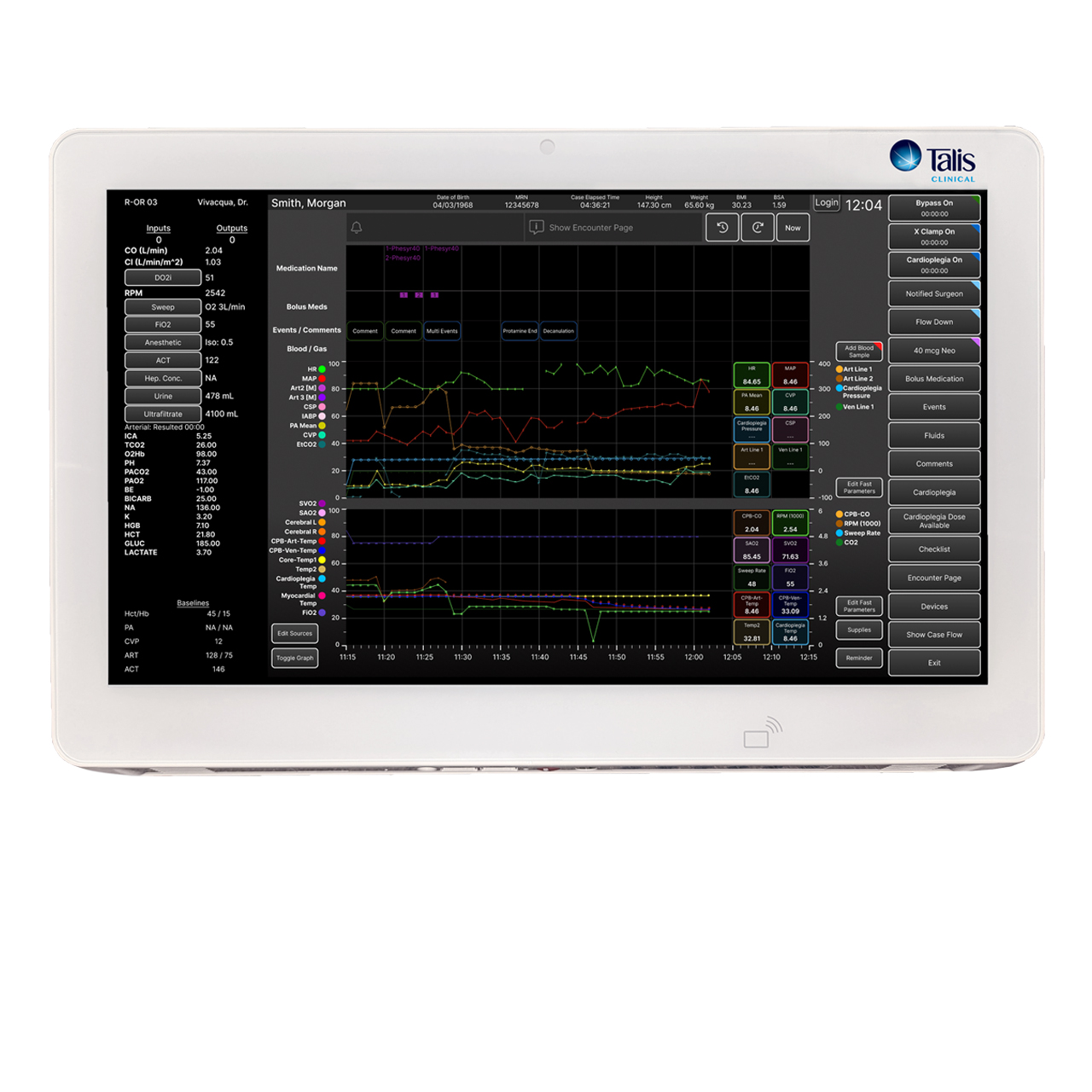 Talis Perfusion with +ACG