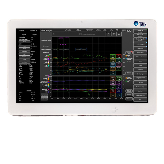 Talis Perfusion with +ACG on computer screen