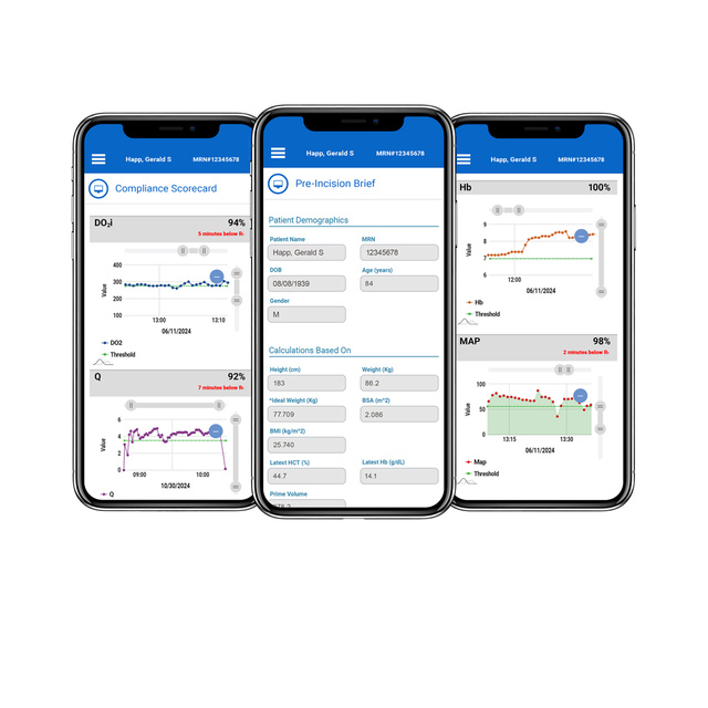 Talis Perfusion on 3 mobile screens