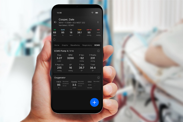 Talis ECMO Tab on Mobile