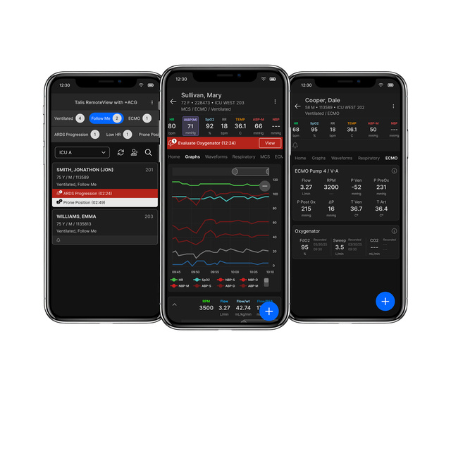 Talis RemoteView with +ACG on mobile