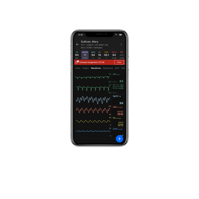 Talis RemoteView with +ACG on mobile