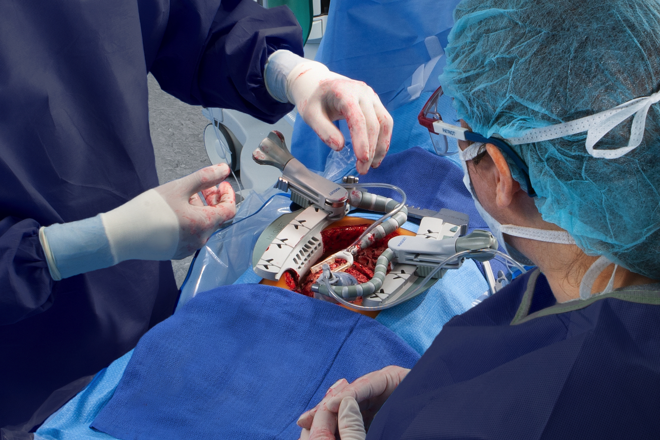 Beating heart surgery