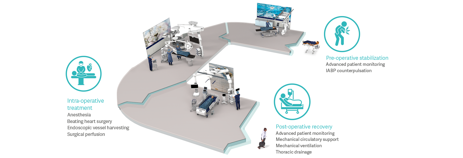Coronary artery bypass grafting patient flow