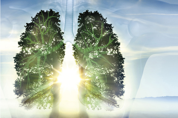 ARDS tree lung image ARDS tree lung image