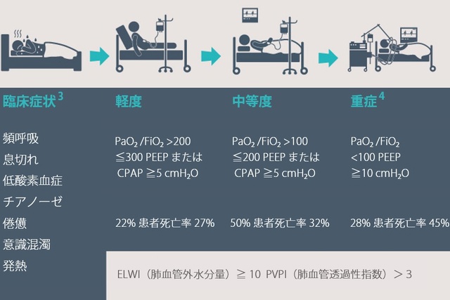 ARDS の臨床兆候および症状の画像