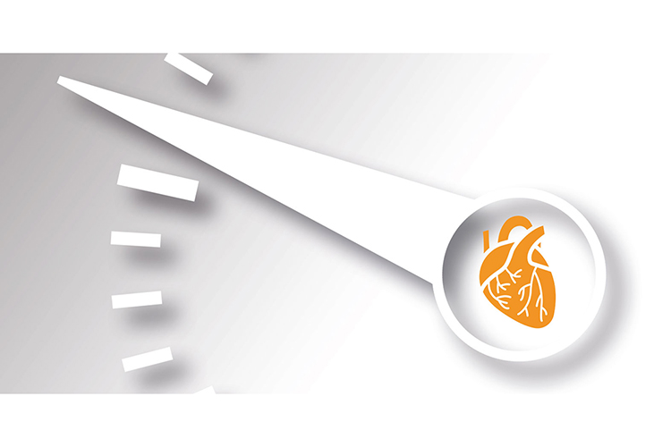 cardiogenic-shock-hero-750x500.jpg