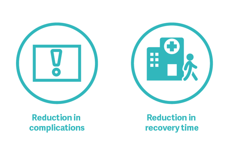 Individualized advanced hemodynamic monitoring improves outcomes Better outcomes through individualized hemodynamic management