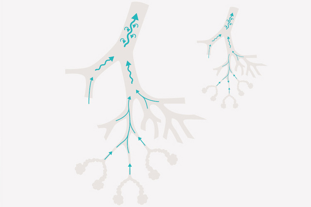 bronchial tree in patients with obstructive lung disease