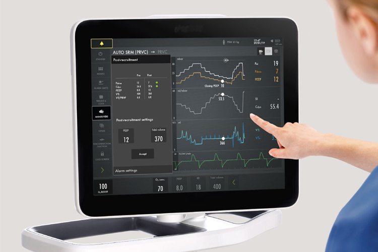 Clinicians hand touching screen of a Getinge Servo-u mechanical ventilator in Automatic Stepwise Recruitment Maneuver mode Clinicians hand touching screen of a Getinge Servo-u mechanical ventilator in Automatic Stepwise Recruitment Maneuver mode