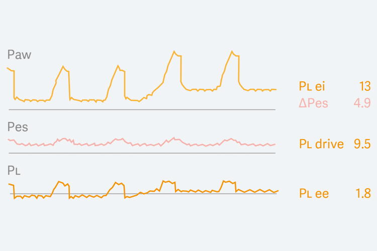 Graphic illustration showing the esophageal PES and transpulmonary pressure PL waveforms 