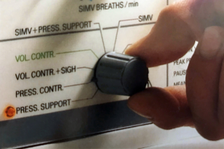 Hand rotating Pressure Control Ventilation dial to SIMV and Pressure Support position on Servo 900 mechanical ventilator Hand rotating Pressure Control Ventilation dial to SIMV and Pressure Support position on Servo 900 mechanical ventilator