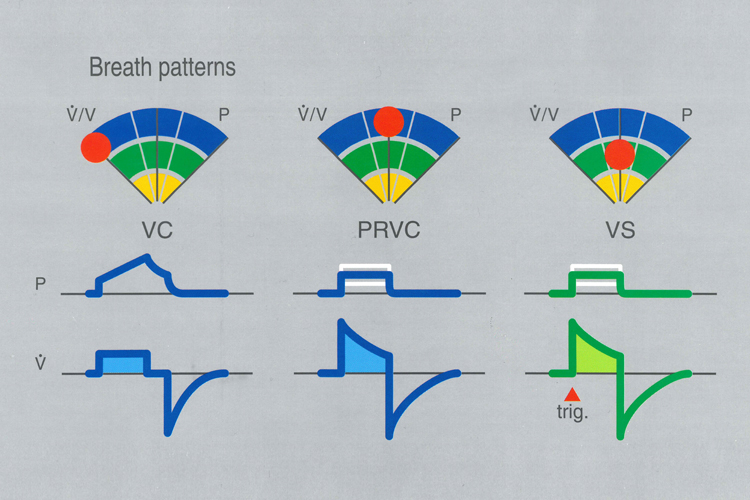 Graphic illustration depicting PRVC and VS Volume-targeted Ventilation breath patterns 