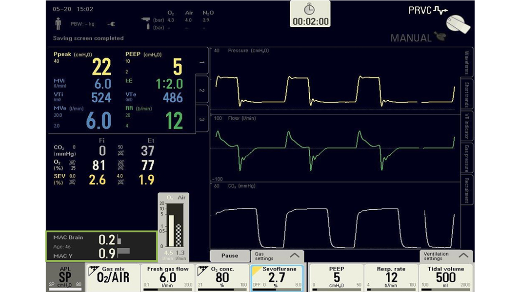 MAC Brain Flow Family anesthesia MAC Brain Flow Family anesthesia