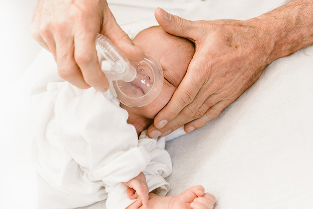 Baby ventilated with Flow-i